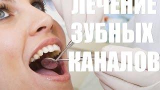 Лечение зубных каналов. О важности диганостики и КТ при лечение каналов.