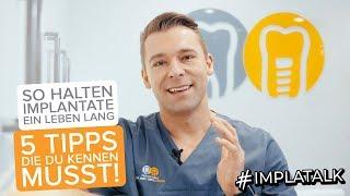 So halten Implantate ein Leben Lang - 5 Tipps, die du kennen musst!