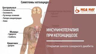 Инсулинотерапия при кетоацидозе