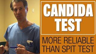 What Does Candida Look Like? How to Know if You Have Candida