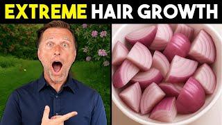 Onion Juice for Extreme Hair Growth: Stop Hair Loss