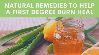 Natural Remedies To Help A First Degree Burn Heal