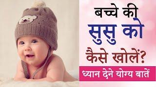 Baby Boy ka susu kaise khole | Kaise Open Kare | How to open private part of Baby Boy