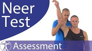 Neer Test | Subacromial Pain Syndrome