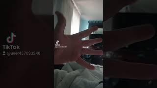 Hand