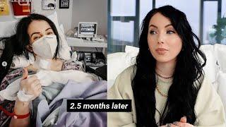 Neck Surgery/Health Update 2.5 Months Later & doing what I should've done