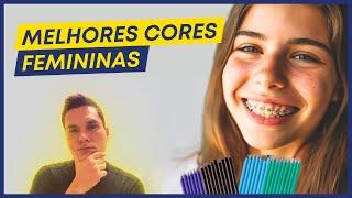 MELHORES CORES DE APARELHO FEMININAS!