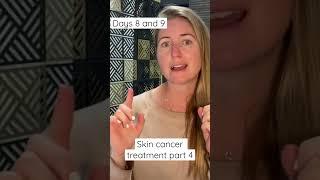 Fluorouracil skin cancer treatment part 4