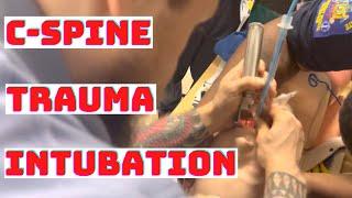 How to Intubate Cervical Spine (C-Spine)Trauma Injury Patient? MAC DL Standard Geometry