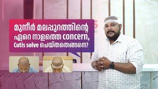 മുനീർ മലപ്പുറത്തിന്റെ ഏറെ നാളത്തെ concern, Cutis solve ചെയ്തതെങ്ങനെ? |  MUNEER MALAPPURAM