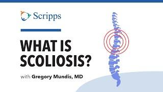 Scoliosis: Symptoms and Treatment with Dr. Gregory Mundis | San Diego Health