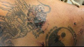 Woman says marks covering her back are from a carjacker | WSB-TV