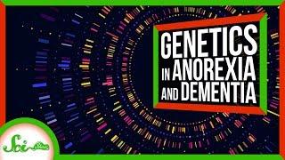 Anorexia Isn't Just a Psychiatric Disorder