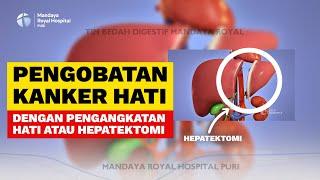 Pengobatan Kanker Hati Operasi Hepatektomi - Prof Toar JM Lalisang, Sp.B, Subs.BD (K) - Mandaya Puri