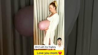 triple baby pregnancy challenge #junior #doctor #baby #challenge #adorable #mom #respectparents