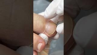 Система препаратного педикюра 10|11 #педикюр #nails #pedicure #ногти #podologia #обучениепедикюру