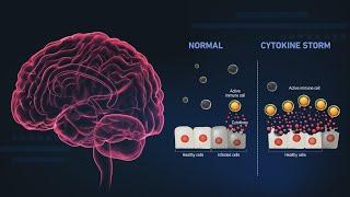 Covid psychosis: Understanding how the virus can hijack the brain