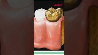 Консультации для удобства стоматолога и пациента #vatech #стоматология #рентген #зубы