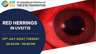 TEF EYEEDU - RED HERRINGS IN UVEITIS