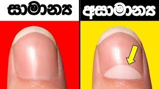 ඔයා  සුපිරි බුද්ධිමතෙක් බවට අගවන ලකුණු 8ක් l ලෝක ප්‍රසිද්ධ බුද්ධි පරීක්ශනය