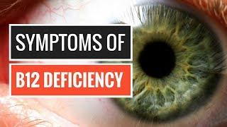 5 Signs and Symptoms of Vitamin B12 Deficiency