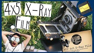 4x5 X-RAY Film | SHOOT, DEVELOP & SCAN