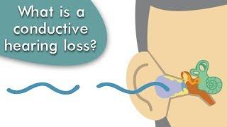 Conductive Hearing Loss Explained