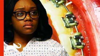 My Braces Could Have Killed Me | Monsters Inside Me