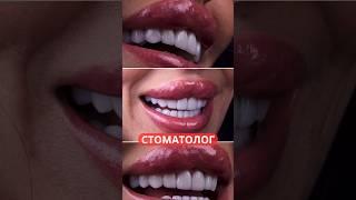 Самый лучший стоматолог Ташкента