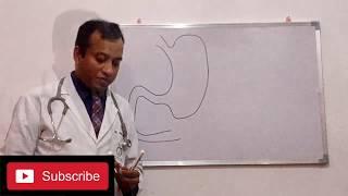 Endoscopy treatment of  Obesity and Diabetes
