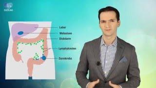 Darmkrebs: Vorsorge rettet Leben!