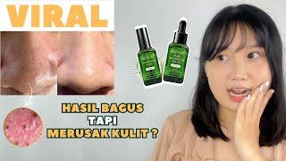 PRODUK PENGHILANG KOMEDO TERBAIK TERNYATA HASILNYA BEGINI.... | BREYLEE BLACKHEAD MASK REVIEW