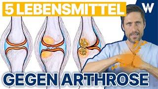 Top 5 Lebensmittel bei Arthrose: Richtige Ernährung um Gelenkprobleme und Schmerzen zu reduzieren