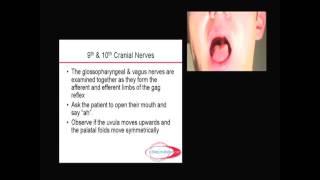 Neurology - Topic 5g - Cranial Nerve 9,10 with notes