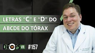 LETRAS “C" E "D” DO ABCDE DO TÓRAX – CORAÇÃO, CENTRO E DIAFRAGMA