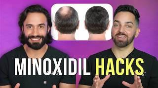 Minoxidil & Hair Growth Hacks That Will Change Your Life | Doctorly Tips