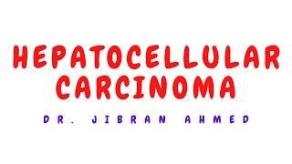 HEPATOCELLULAR CARCINOMA II SYSTEMIC PATHOLOGY II ROBBINS 10TH E II SIMPLY PATHOLOGY