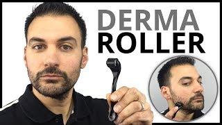 Derma Roller - Patchy Beard Growth Solution?