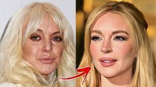 Celebrities Who REVERSED Cosmetic Procedures in 2024