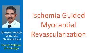 Ischemia guided myocardial revascularization