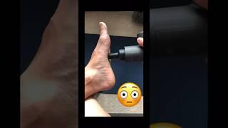 Mesmerizing  #foot #massage #fitness #plantarisfacitis #footpain