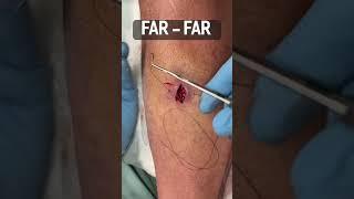 HOW TO SUTURE : VERTICAL MATTRESS STITCH #shorts #medicalstudent