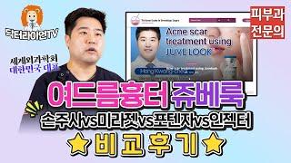 여드름흉터 쥬베룩 효과 손주사vs미라젯(큐어젯)vs포텐자vs인젝터 비교후기