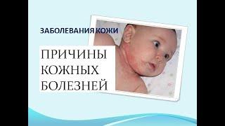 Кожные заболевания причины