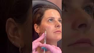 Skinvive is one of the newest injectables on the market! #injector #glowingskin #scottsdale