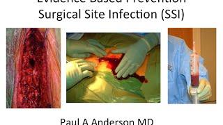 Prevention of Surgical Site Infection by Paul Anderson, M.D., M.S