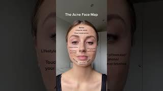 What your breakouts are telling you! #nipandfab #acnefacemap #acneproneskin #acnebreakout #acne