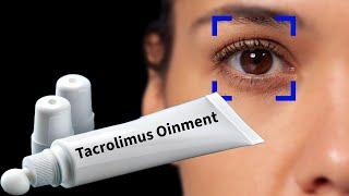 Stop Doing this! | Tacrolimus Oinment & Lotion