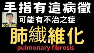 肺部纖維化: 要留意手指這些變化！及早發現才能控制病情！ hand signs of lung fibrosis