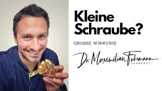 Kleine Schraube? Große Wirkung! | Zahnarzt Dr. Maximilian Fuhrmann